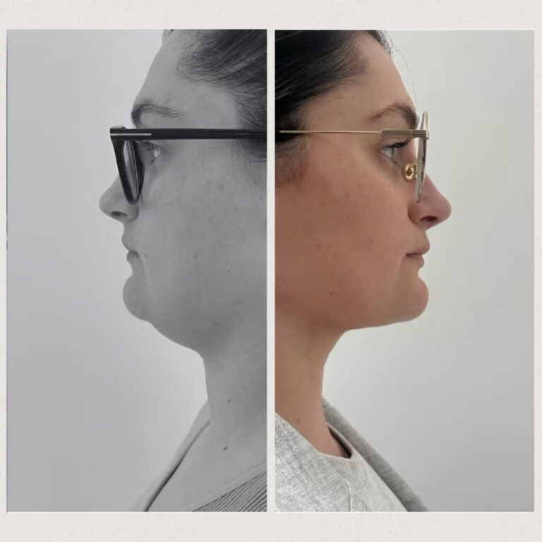 TW Care - Instagram GRID - Marzec - Kwiecień 2025 - 3